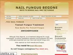 Sites similar to toefungus.org
