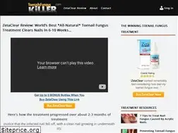 Sites similar to toenailsfunguskiller.com