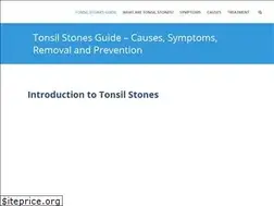 Sites similar to tonsilstoness.com
