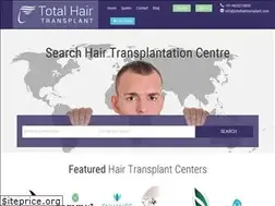 Sites similar to totalhairtransplant.com