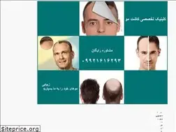 Sites similar to transplanthair.ir