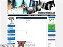 Sites similar to traumatologia.cl