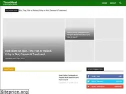 Sites similar to treatheal.com