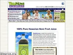 Sites similar to trunoni.com