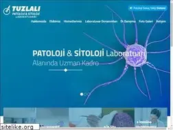 Sites similar to tuzlalipatoloji.com