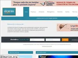 Sites similar to ulceras.net