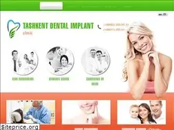Sites similar to uzimplant.uz