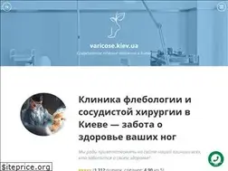 Sites similar to varicose.kiev.ua