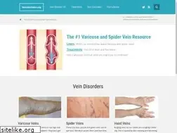 Sites similar to varicoseveins.org