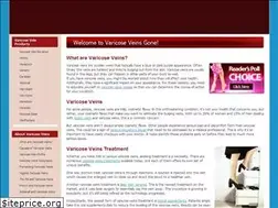 Sites similar to varicoseveinsgone.com