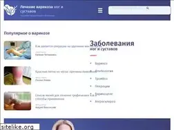 Sites similar to varikoznik.com