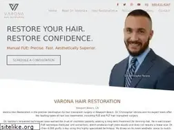 Sites similar to varonahairrestoration.com