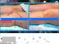 Sites similar to venocure.com