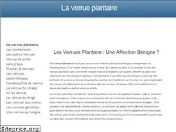Sites similar to verrueplantaire.fr