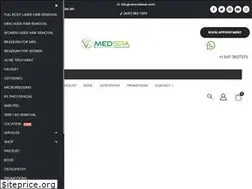 Sites similar to versuslaser.com