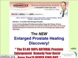 Sites similar to vigarexx.com