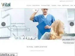 Sites similar to vitalimplantes.com.br