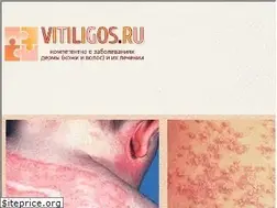 Sites similar to vitiligos.ru