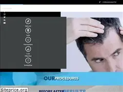 Sites similar to vplanthairclinics.com