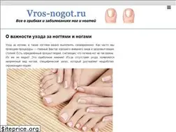 Sites similar to vros-nogot.ru