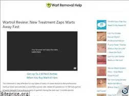 Sites similar to wartremovalhelp.com