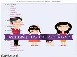 Sites similar to what-is-eczema.com