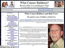 Sites similar to whatcausesbaldness.net