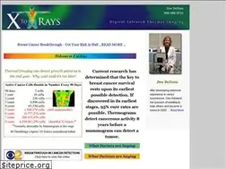 Sites similar to xtorays.com