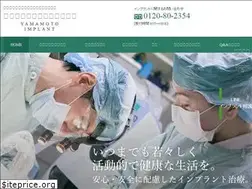Sites similar to y-implant.com