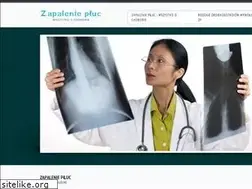 Sites similar to zapaleniepluc.eu
